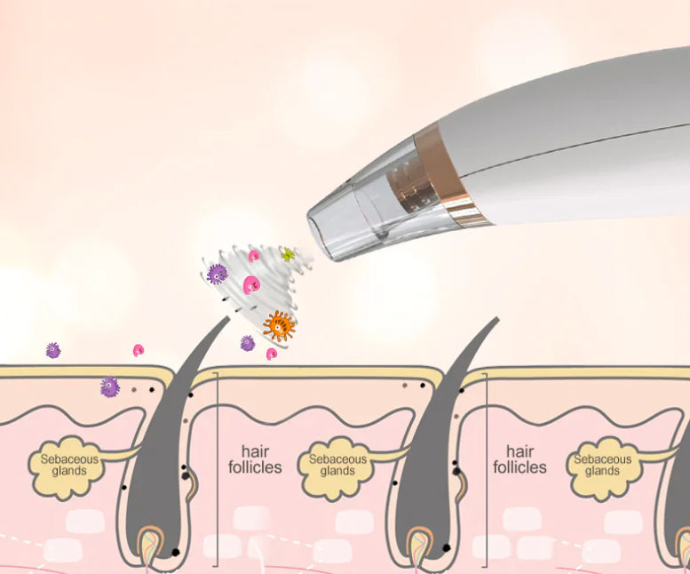 Home Pore Cleaning Electric Extractor
